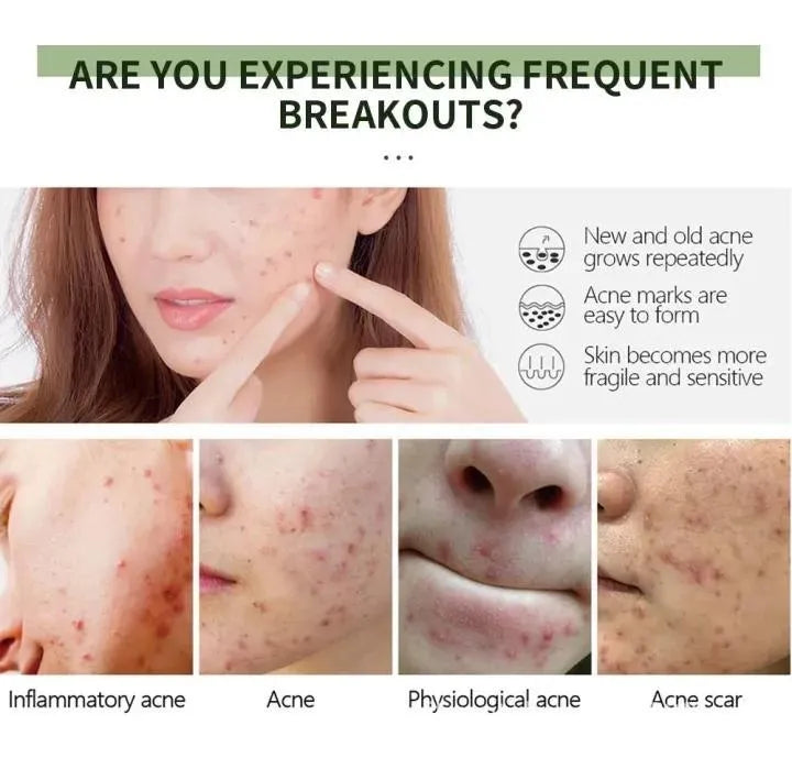 Acne Scar Removal Exfoliating Gel
