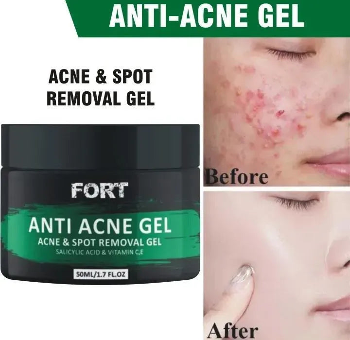 Acne Scar Removal Exfoliating Gel