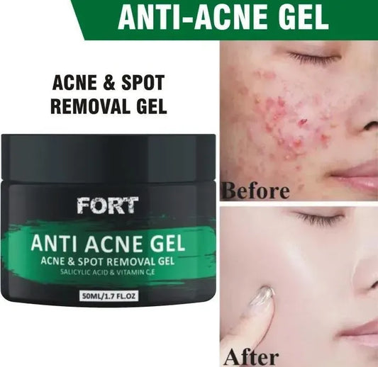 Acne Scar Removal Exfoliating Gel